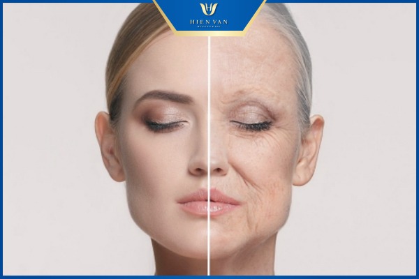 da nào nên điều trị bằng tiêm PRP