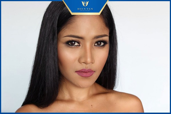 Da ngăm đen dễ bị chứng tăng sắc tố sau viêm