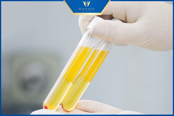 Huyết tương giàu tiểu cầu là gì