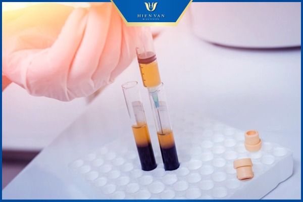 prp bao lâu làm một lần