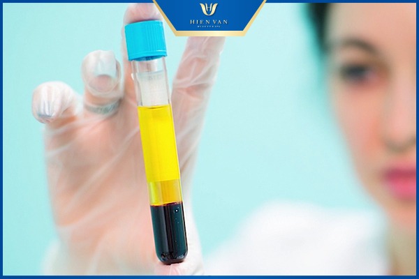 Trị liệu PRP có an toàn không