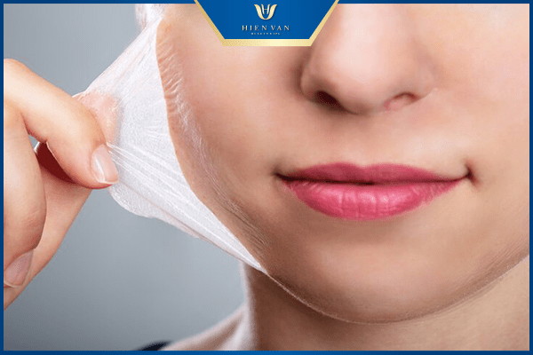 bao lâu thì peel da