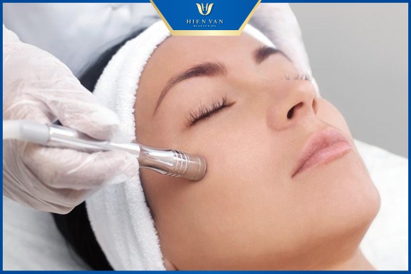 mài da trị sẹo rỗ đáy nhọn