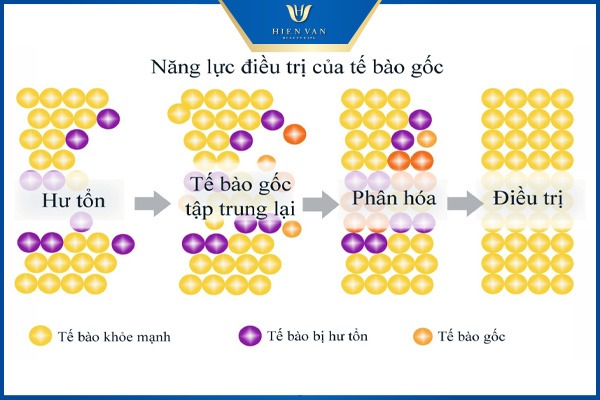 tế bào gốc trị sẹo rỗ tốt nhất hiện nay