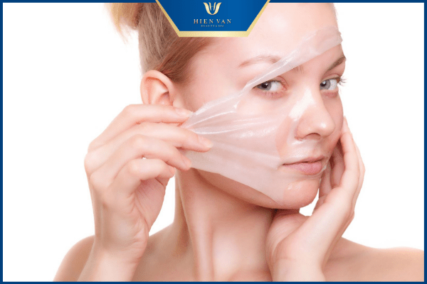 trị thâm mụn nặng