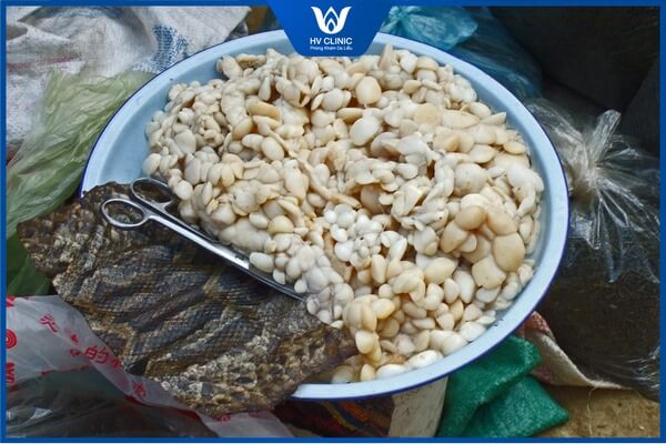 mo tran tri mun co duoc khong