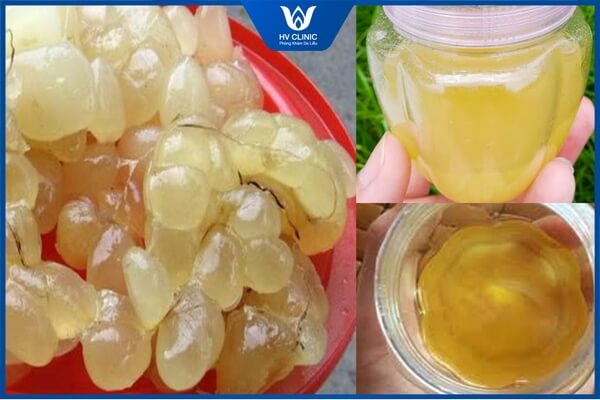 mo tran tri mun nhu the nao