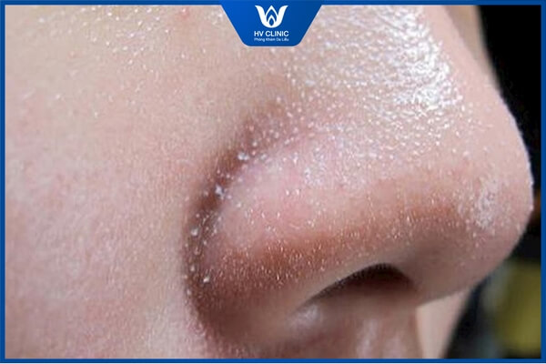 mo tran tri mun tham