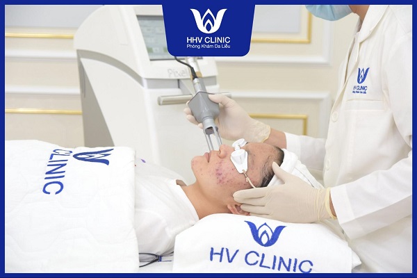 1 lieu trinh tri mun bao nhieu tien