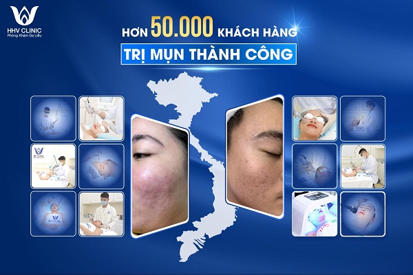 mat na muop dang tri mun