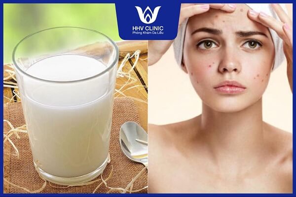 cach tri mun bang sua tuoi khong duong