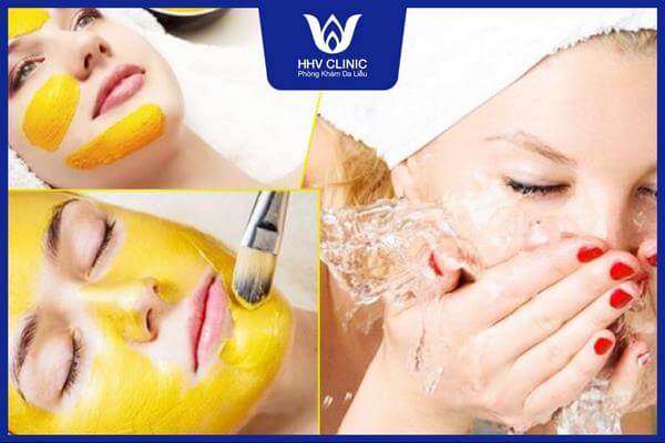 cach tri mun dau den va lo chan long to 1