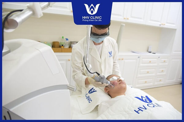 sua tuoi khong duong tri mun