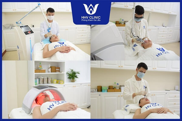 tri mun dau den bang baking soda