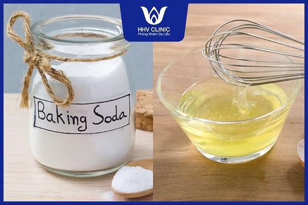 tri mun lung bang baking soda