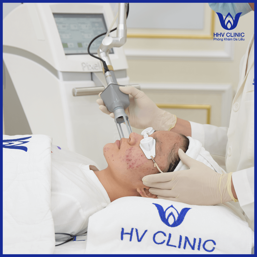 Trẻ hóa da bằng Laser 